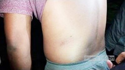 যুবলীগ নেতার শরীরে আঘাতের চিহ্ন
