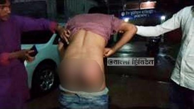 মারধরের শিকার যুবলীগ নেতা গোলাম মোস্তফা