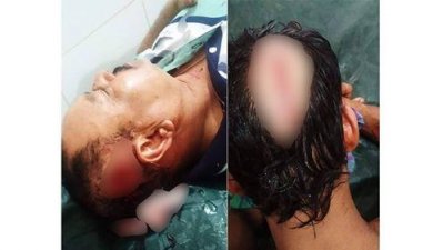 সাবেক ইউপি চেয়ারম্যানসহ তিন জনকে কুপিয়ে জখম