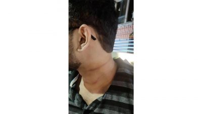 সুতায় কেটে আহত