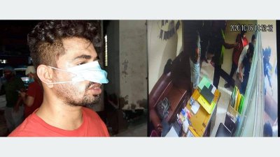 আহত জনি ও সিসিটিভি ফুটেজ 