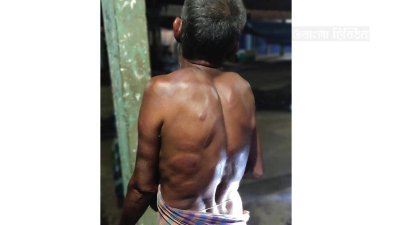 মেয়েকে নির্যাতনের প্রতিবাদ করায় বাবাকে পিটিয়ে আহত করা হয়