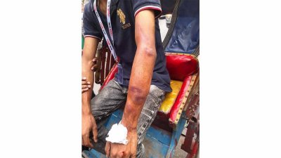 হামলায় আহত আবিদ হাসান রাসেল