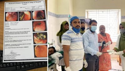 রোগীর পেট থেকে বের হলো ১৫টি কলম
