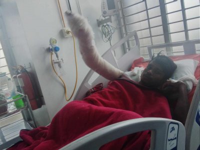 আগুন সন্ত্রাসের কবলে পড়ে বিছানায় কাতরাচ্ছেন পরিবহনশ্রমিকরা