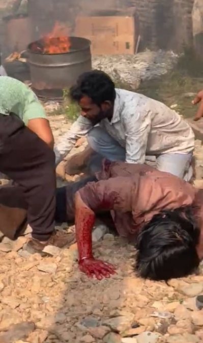 পায়ে আগুন লাগার পরে এভাবে লুটিয়ে পড়েন শুভ