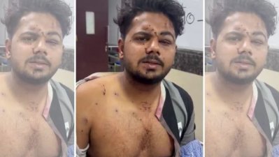 পেলেটে ঝাঁঝরা মুখ, তবু অনুশোচনা নেই: হাসপাতাল থেকেই যন্তর মন্তরে ফেরার ঘোষণা