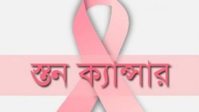 দেশে স্তন ক্যানসারে বেশি আক্রান্ত হন চল্লিশোর্ধ্ব নারীরা