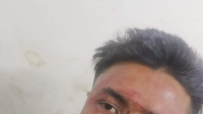 হামলায় আহত ব্যক্তি