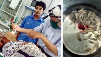 বৃদ্ধার মাথা থেকে বের করা হলো ৬০টি পোকা