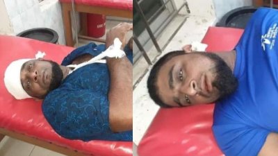 আহত দুই ভাই