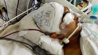 আইসিইউতে চিকিৎসাধীন আকিব