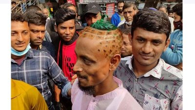 মাথার চুল কেটে আনারসের আকৃতি করেছেন মামুন