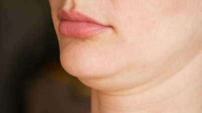 ডাবল চিন দূর করার ৬ টিপস
