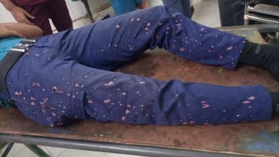 এসিড নিক্ষেপে ঝলসে গেছে পুলিশের প্যান্ট