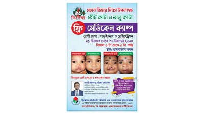 বিনামূল্যে ঠোঁটকাটা-তালুকাটা অপারেশন ক্যাম্প