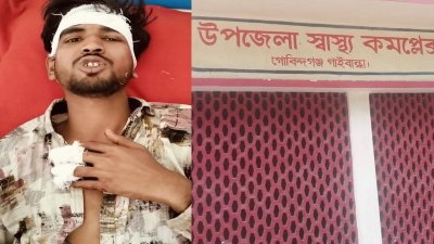 আহত ব্যবসায়ী আব্দুল আউয়ালকে গোবিন্দগঞ্জ উপজেলা স্বাস্থ্য কমপ্লেক্সে ভর্তি করা হয়েছে