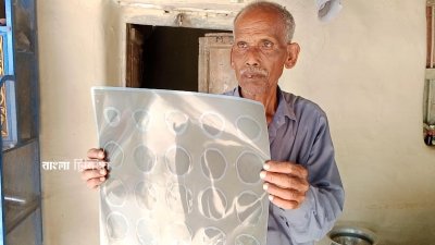 উজ্জ্বল রায়ের সিটি স্ক্যান দেখাচ্ছেন বাবা নরেশ চন্দ্র রায়