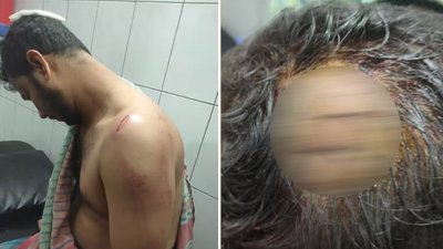 আহত সাদ্দাম হোসেন ফেনীর দাগনভূঞা থানায় পুলিশ কনস্টেবল পদে কর্মরত