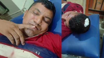 আহত পুলিশ কনস্টেবল রুস্তম আলী