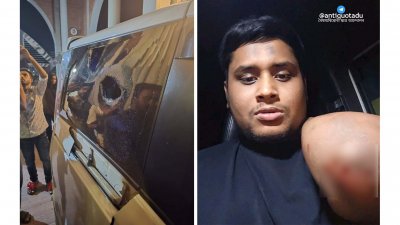 হামলায় গাড়ির কাচ ভেঙে গেছে, আঘাত পাওয়া হাত দেখাচ্ছেন হাসনাত আব্দুল্লাহ