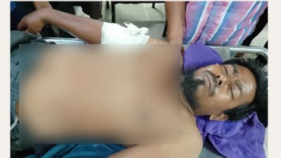 আহত আব্বাস আলী সরকার