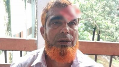 ভুক্তভোগী আবদুল মন্নান মৃধা ওরফে চুন্নু