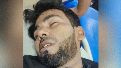 হামলায় আহত প্রবাসী সালাউদ্দিন রিদন