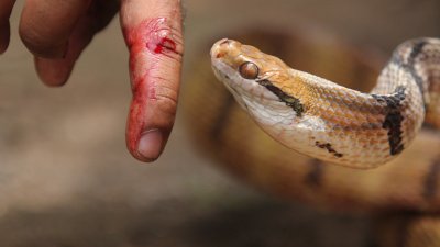শহরে বেড়েছে সাপ: কাটলে কী করবেন