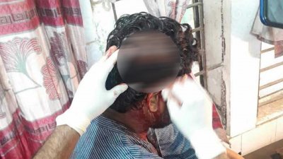 পাবনার ফরিদপুর উপজেলার একটি প্রাথমিক বিদ্যালয়ের শিক্ষার্থীদের পরীক্ষা না নেওয়াকে কেন্দ্র করে বাগবিতণ্ডার জেরে এক শিক্ষকের মাথা ফাটিয়ে দিয়েছেন যুবদল নেতা ও তার সহযোগীরা