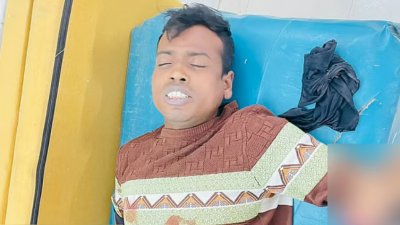 আহত আক্তার হোসেনকে খুলনা মেডিক্যাল কলেজ হাসপাতালে ভর্তি করা হয়