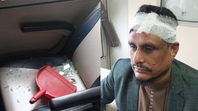ট্রেনে পাথর নিক্ষেপের ফলে আহত যাত্রী