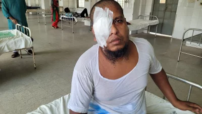 মাওলানা ইউসুফ আলীর চোখের ক্ষতি হয়েছে