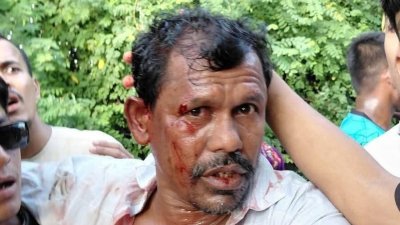 আহত ইউপি সদস্য