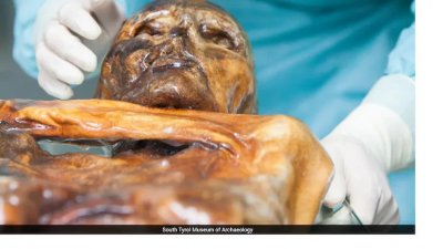 ওতজির অন্ত্রে সক্রিয় থাকা ব্যাকটিরিয়াগুলো তার শেষ খাবারের সঙ্গে হুবহু মিলে যায়। ছবি: সাউথ টায়রল জাদুঘর