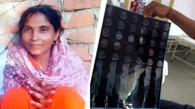 গুড্ডি দেবী সড়ক দুর্ঘটনায় পায়ের ভাঙা হাড়ের চিকিৎসার জন্য হাসপাতালে ভর্তি হয়েছিলেন। ছবি: ইন্ডিয়া টুডে