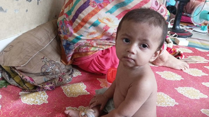 হামে আক্রান্ত শিশু