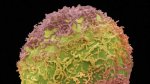 prostate_cancer