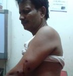 আহত যুবলীগ নেতা