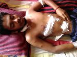 গুরুতর আহত মৃন্ময়, এখন অনেকটাই আশঙ্কামুক্ত